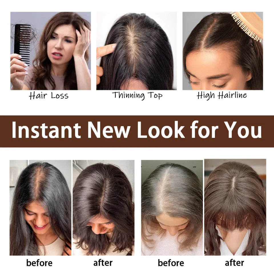 Dazzeal 100% Real Human Hair Toppers for Women-1
